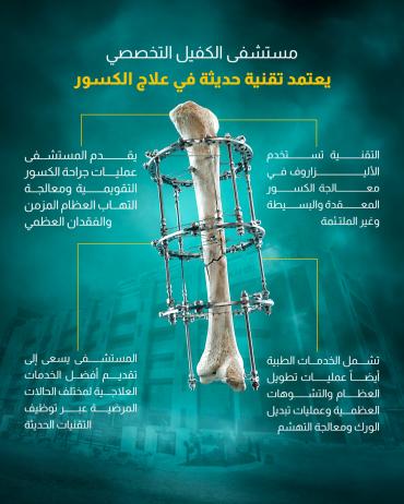 مستشفى الكفيل التخصصي يعتمد تقنية حديثة في علاج الكسور 