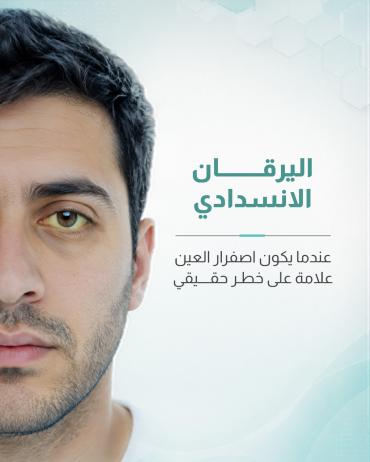اليرقان الانسدادي عندما يكون اصفرار العين علامة على خطر حقيقي