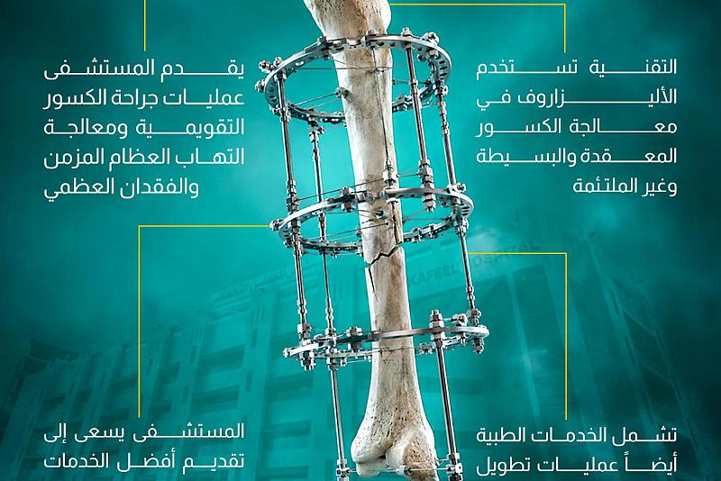 مستشفى الكفيل التخصصي يعتمد تقنية حديثة في علاج الكسور 