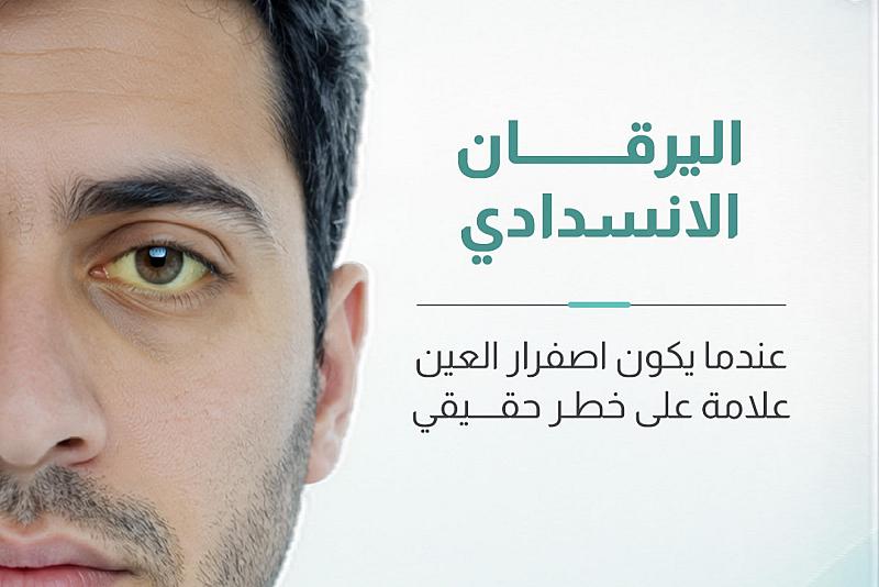 اليرقان الانسدادي عندما يكون اصفرار العين علامة على خطر حقيقي